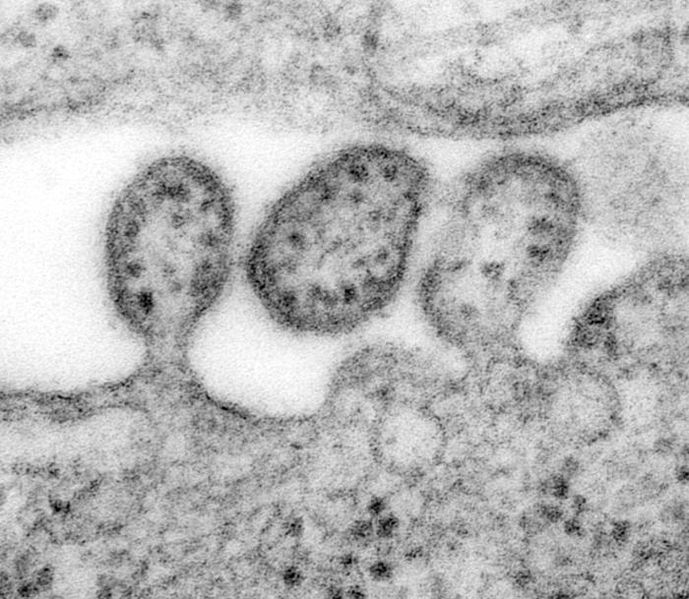 over 80 People Die In Nigeria From Lassa Fever Outbreak