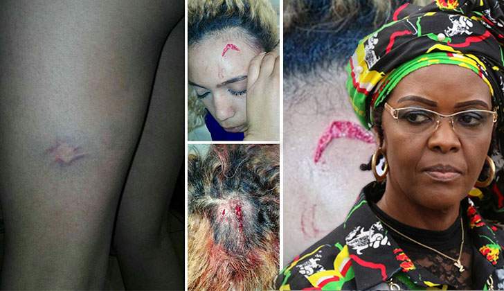 Debbie Engels, mother to Gabriella Engels who was attacked by Zimbabwe’s First Lady  Grace Mugabe, speaks about her daughter’s traumatic experience