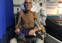 ‘Let down by the system’: 6stone, severely ill emaciated man deemed fit for work by Department for Work and Pensions (DWP),  dies