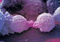 ‘AN IMMUNE  cell which kills most cancers has been discovered by accident by British scientists, in a major breakthrough in treatment’.