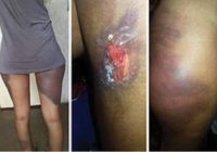 SIX BULAWAYO  (ZRP) ,who were arrested on Friday and , accused of savagely beating up two Bulawayo women, failed to appear in court yesterday after their victims accused (ZRP) of trying to cover up the crime.