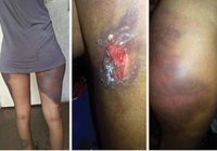 THE trial of six police officers who allegedly brutalised two women from Bulawayo’s Cowdray Park suburb for allegedly violating lockdown regulations started on Wednesday